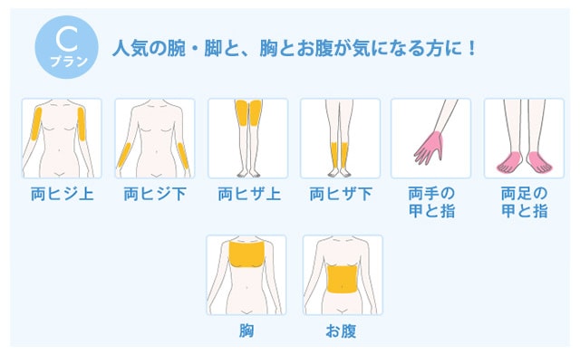 全身脱毛コースライトCプラン