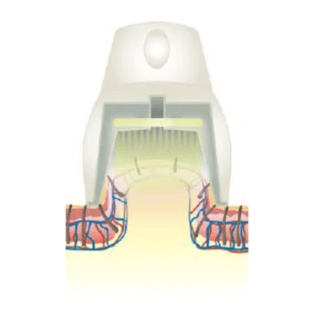 吸引機能