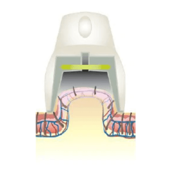 吸引機能