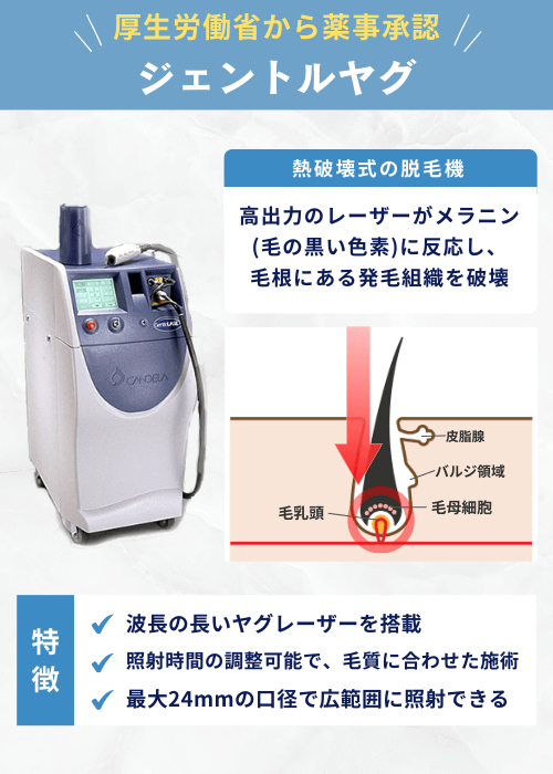 ジェントルヤグ